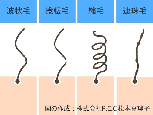 くせ毛のタイプ別解説イラスト図