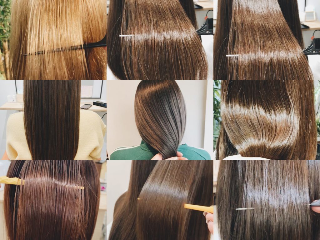 バイカルテの施術後写真