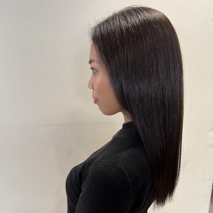 施術後のモデルさんの横顔の写真