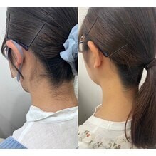 セミロングの髪を下でくくっている女性のうなじのbefore/after